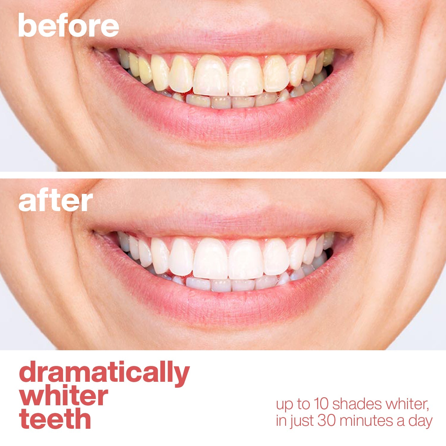 Professional Teeth Whitening Strips