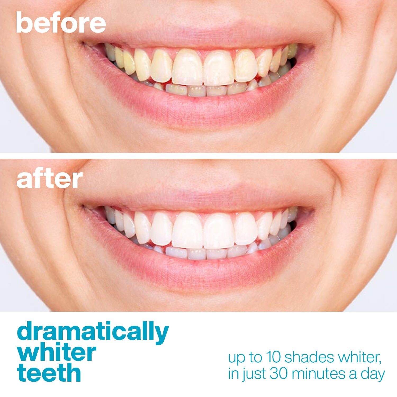 Professional Teeth Whitening Strips